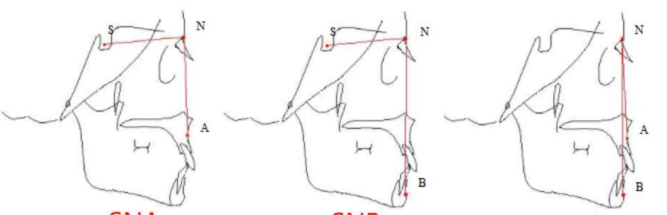 src-TVRZNMTY5ODE4Nzg0MgaHR0cHM6Ly9kaW5neXVlLm5vc2RuLjEyNy5uZXQvYTRjRXp4TW9hd1VhUTFrNFg4PWJuSGlhOHUxMmFHejRHcmRNYVRiQ2ROb2dZMTUzNTE3NDk5MDEyOS5qcGc=.jpg